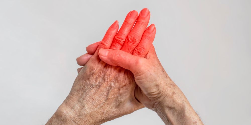 rheumatoid arthritis